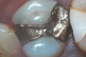 A képet nem sikerült megjeleníteni