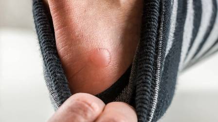 A kpet nem sikerlt megjelenteni